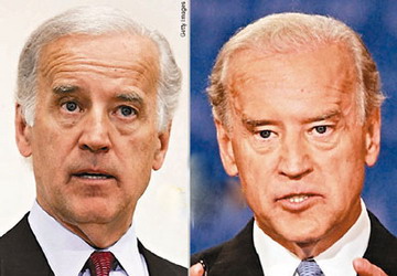 �ݵ�Ҳ���� ��ָ����(j��ng)���^��Ƥ�������g(sh��)(�D)